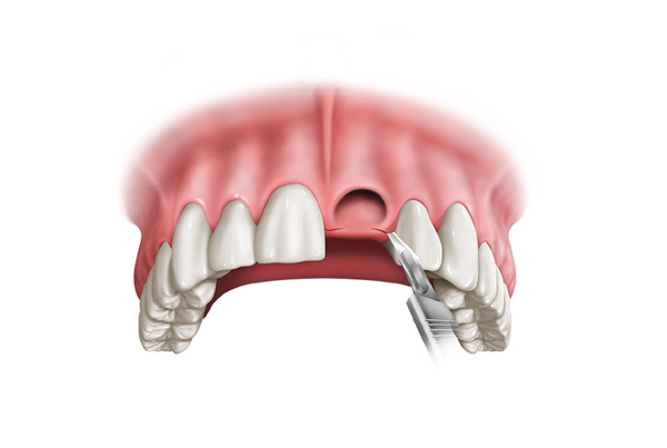 Best Prosthodontic Treatment